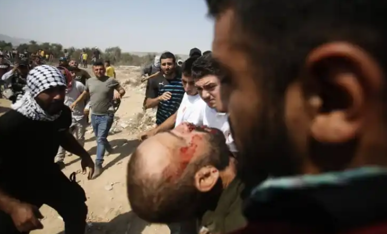 شهيد و21 إصابة بقمع الإحتلال مسيرة سلمية في بيتا